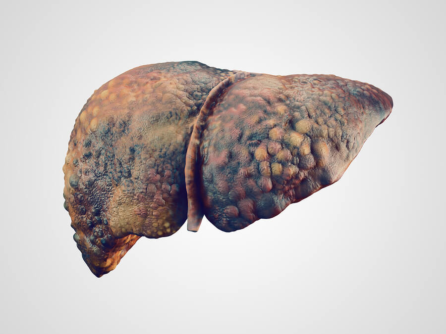 Signs of Liver Disease | Midwood Addiction Treatment
