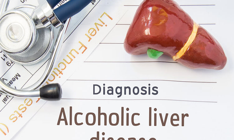 Signs of Liver Disease